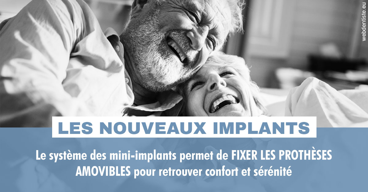 https://www.dr-vincent-stephane.fr/Les nouveaux implants 2