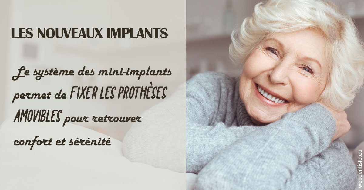 https://www.dr-vincent-stephane.fr/Les nouveaux implants 1