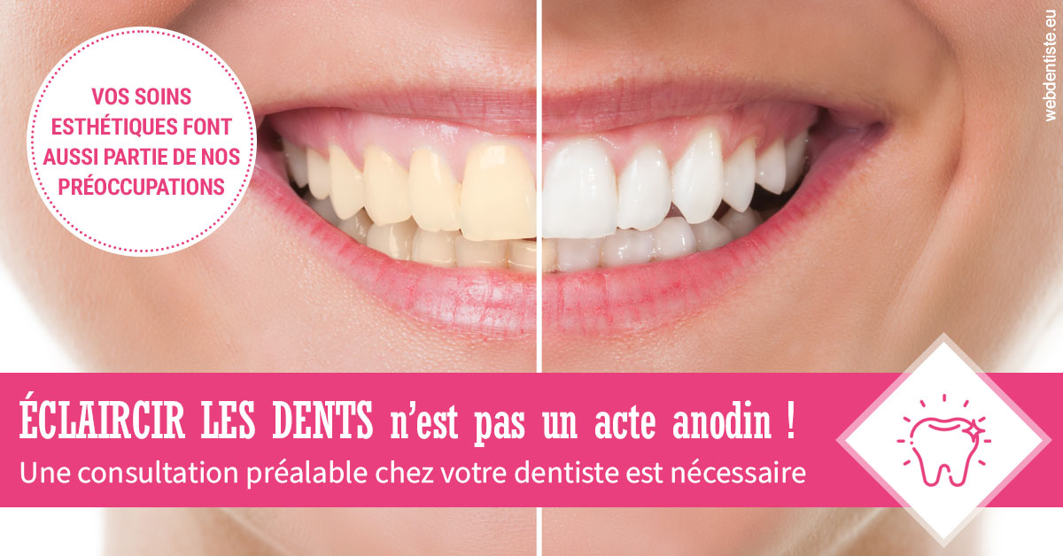https://www.dr-vincent-stephane.fr/2024 T1 - Eclaircir les dents 01