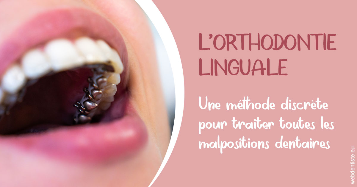 https://www.dr-vincent-stephane.fr/L'orthodontie linguale 2