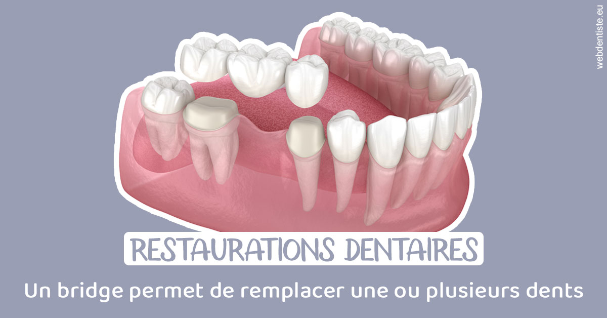 https://www.dr-vincent-stephane.fr/Bridge remplacer dents 1
