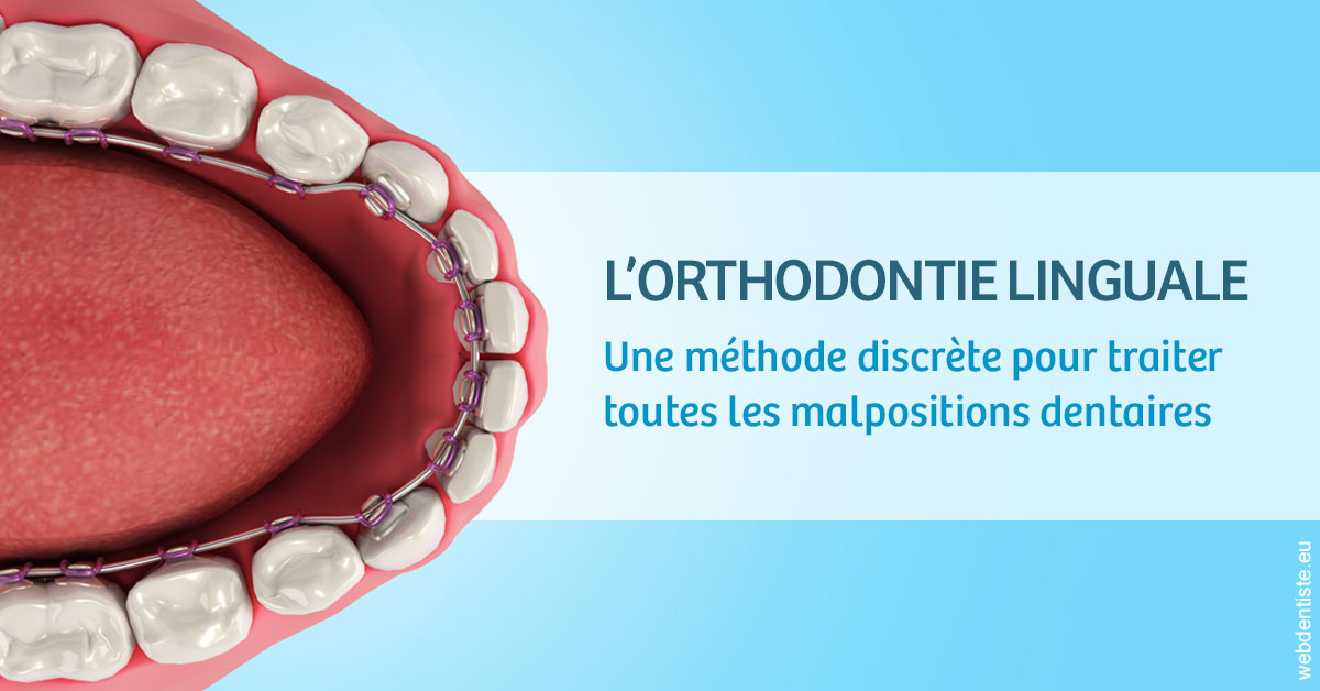 https://www.dr-vincent-stephane.fr/L'orthodontie linguale 1