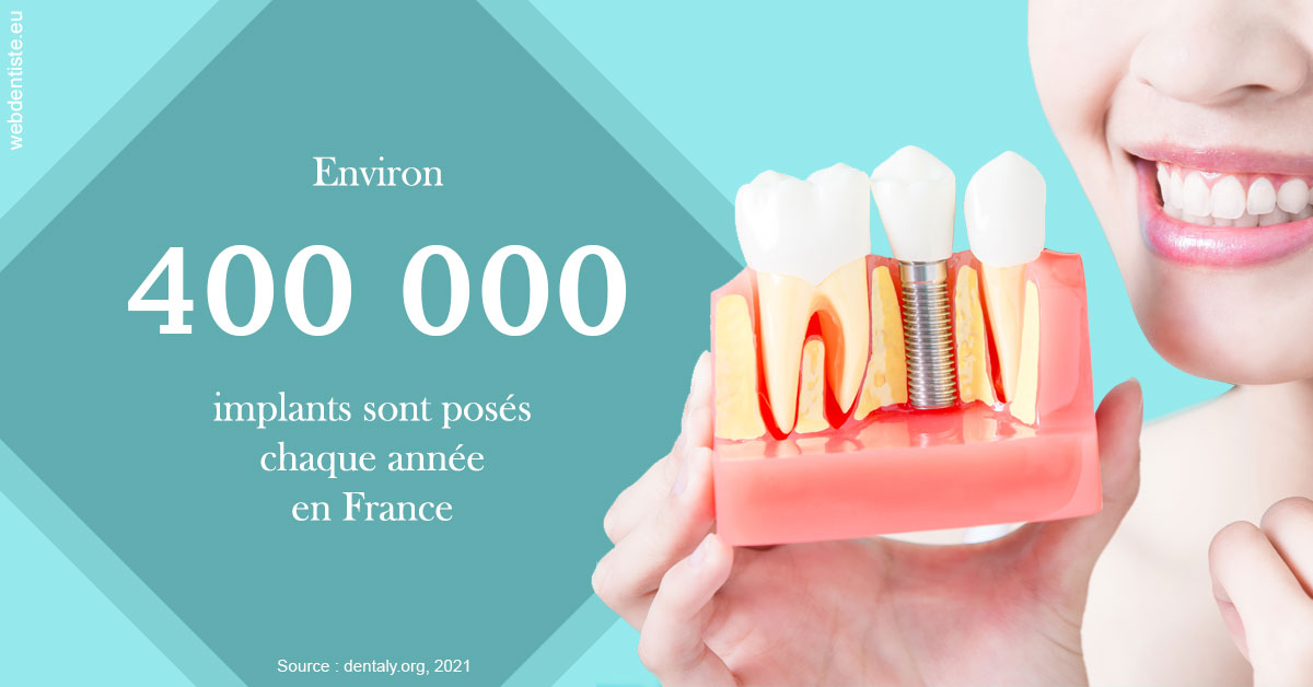 https://www.dr-vincent-stephane.fr/Pose d'implants en France 2