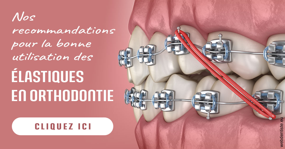 https://www.dr-vincent-stephane.fr/Elastiques orthodontie 2